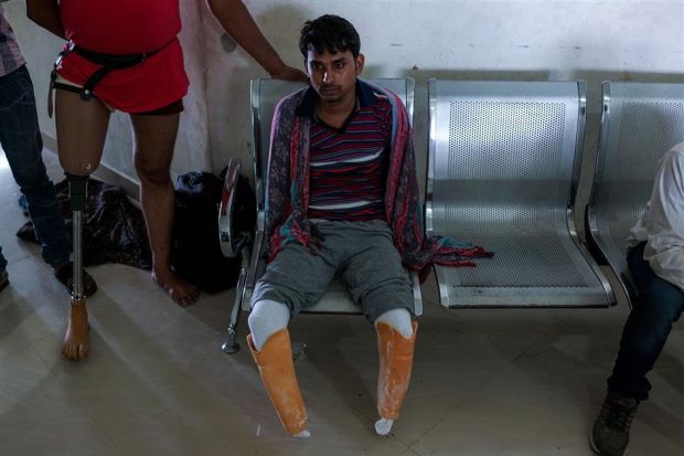 Low-cost prostheses offer Indian amputees a second chance