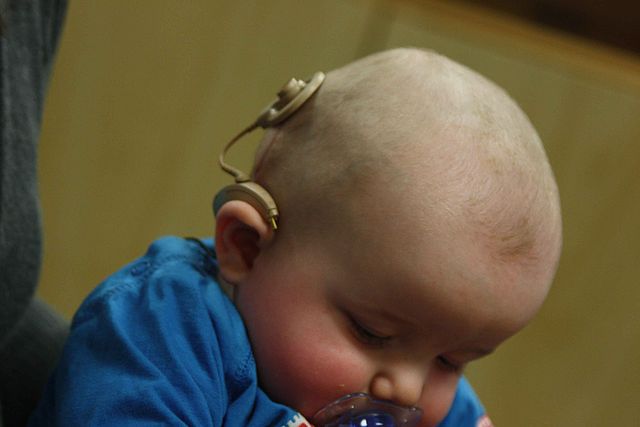 GST charged on cochlear implants