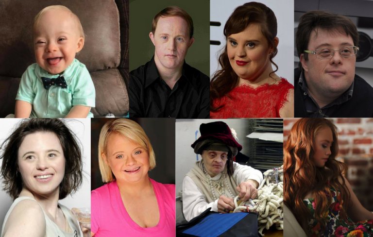mosaic down syndrome celebrities