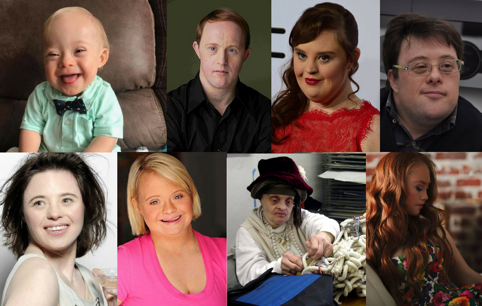 Success in All Shapes: Celebrities with Down Syndrome