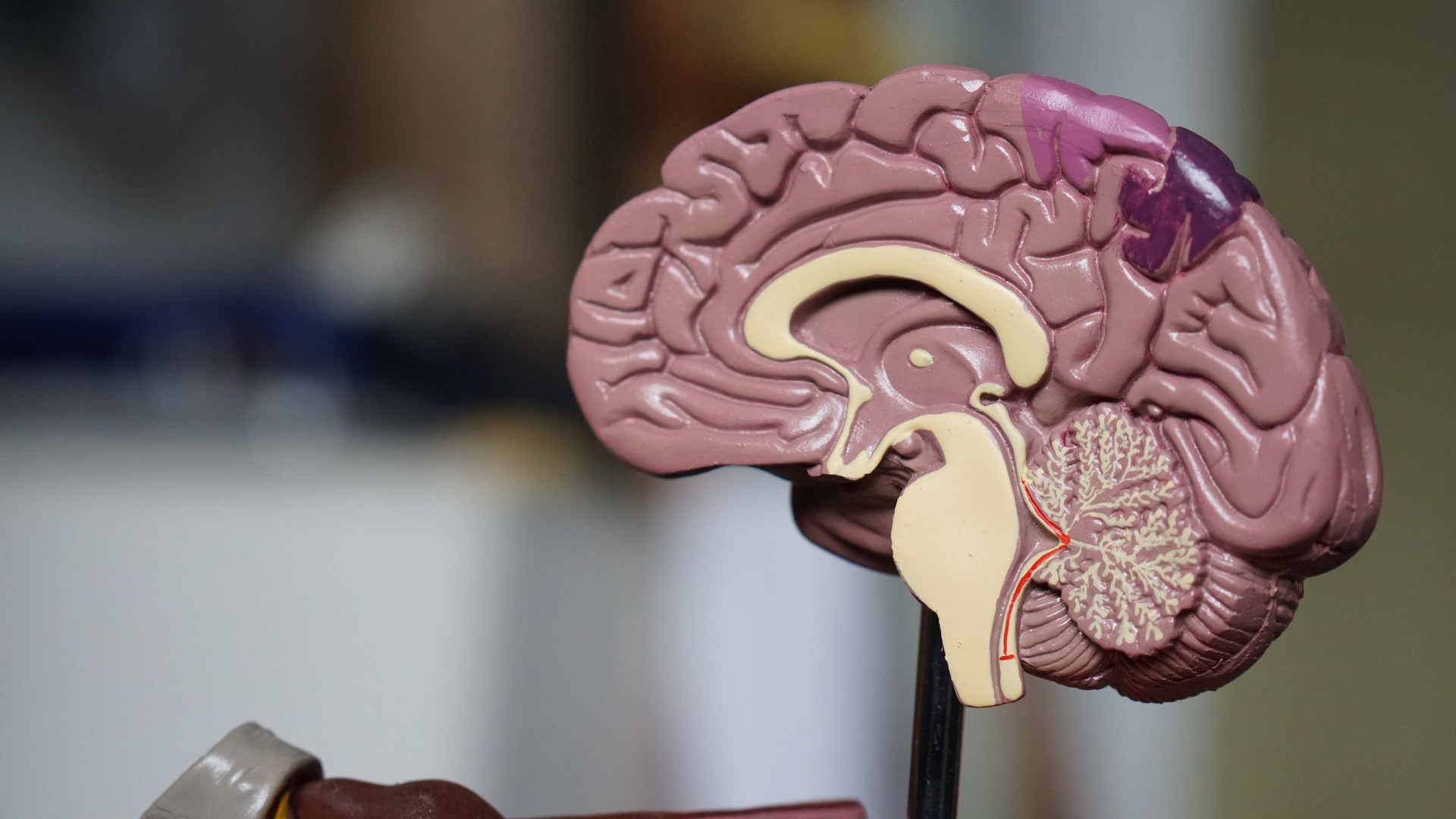 A model cross-section of a human brain